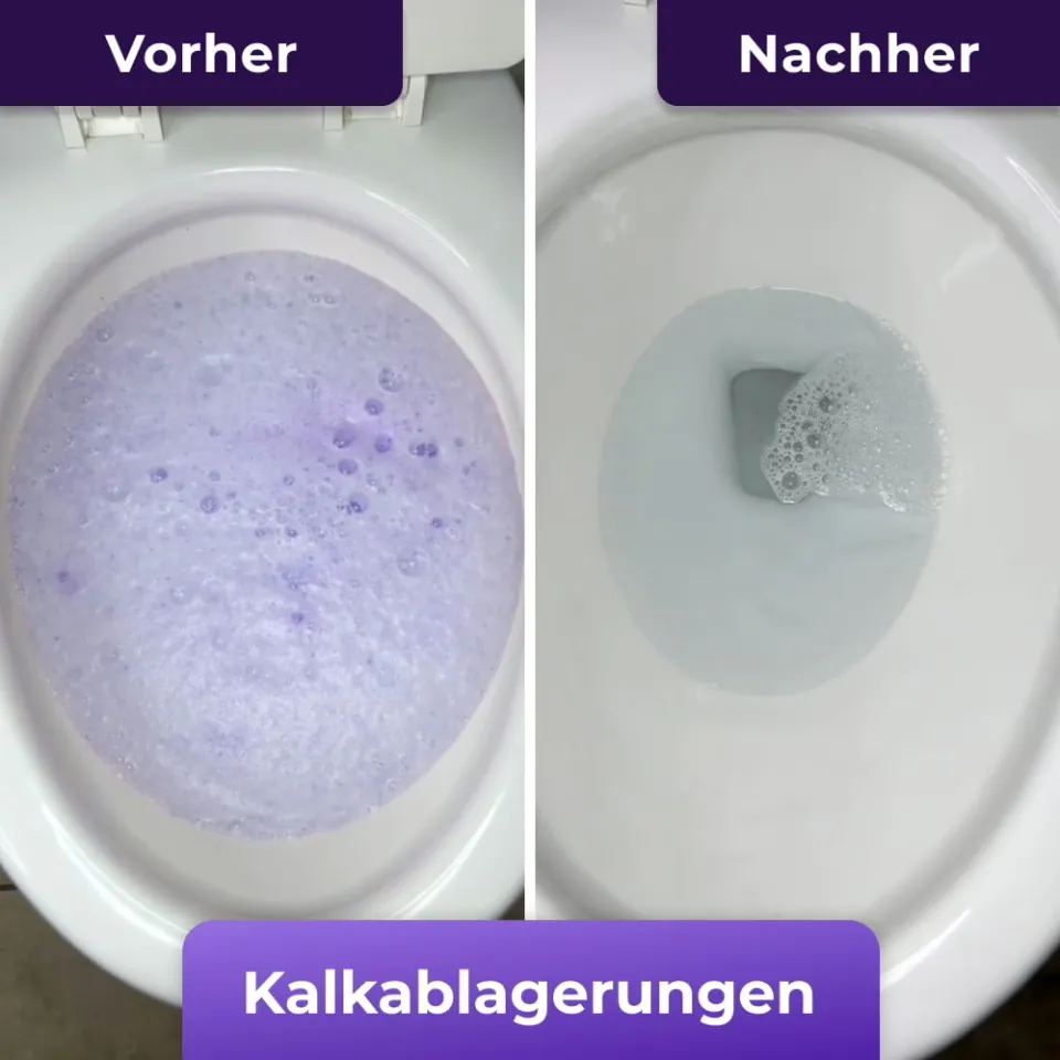 FizzClean Vorher Nachher Toilettenreinigung