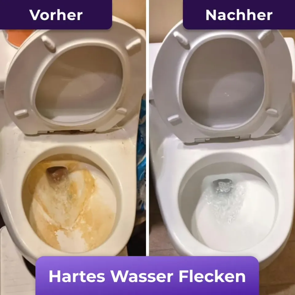 FizzClean Vorher Nachher Toilette sauber